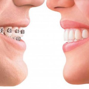 ortodoncia - branemark lleida