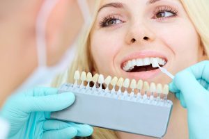 ¿Qué puede hacer por ti la estética dental?